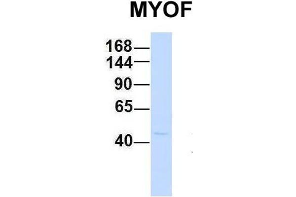 Myoferlin 抗体  (C-Term)