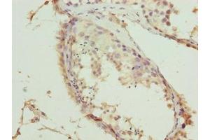 Immunohistochemistry of paraffin-embedded human testis tissue using ABIN7173492 at dilution of 1:100 (TRMT6 抗体  (Catalytic Subunit))