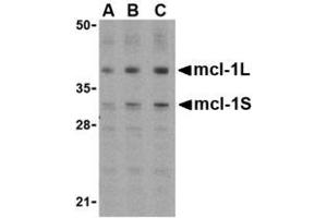 Image no. 1 for anti-Induced Myeloid Leukemia Cell Differentiation Protein Mcl-1 (MCL1) (Internal Region) antibody (ABIN207776) (MCL-1 抗体  (Internal Region))