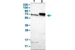 Western Blot analysis with TOMM70A polyclonal antibody . (TOM70 抗体  (AA 383-512))