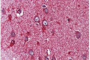Anti-NR4A3 antibody  ABIN1049141 IHC staining of human brain, cortex. (NR4A3 抗体  (Internal Region))