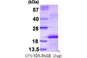 SDS-PAGE (SDS) image for Colony Stimulating Factor 1 (Macrophage) (CSF1) (AA 33-190) protein (His tag) (ABIN666654) (M-CSF/CSF1 Protein (AA 33-190) (His tag))