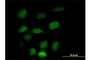 Immunofluorescence of purified MaxPab antibody to ZNF157 on HeLa cell. (ZNF157 抗体  (AA 1-506))