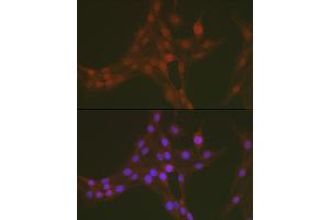 Immunofluorescence analysis of PC-12 using Phospho-FoxO1-S256 antibody (ABIN3019709, ABIN3019710, ABIN3019711 and ABIN6225492) at dilution of 1:50.