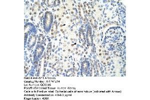 Rabbit Anti-SF1 Antibody  Paraffin Embedded Tissue: Human Kidney Cellular Data: Epithelial cells of renal tubule Antibody Concentration: 4.
