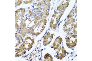 Immunohistochemistry of paraffin-embedded human stomach using HYAL1 antibody (ABIN5975045) at dilution of 1/100 (40x lens). (HYAL1 抗体)