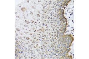 Immunohistochemistry of paraffin-embedded human esophagus using FANCL antibody (ABIN5995461) at dilution of 1/100 (40x lens). (FANCL 抗体)