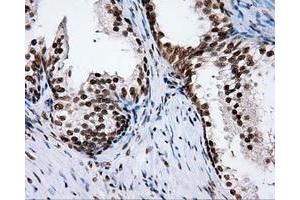 Immunohistochemical staining of paraffin-embedded Kidney tissue using anti-RC204952 mouse monoclonal antibody. (XRCC1 抗体)