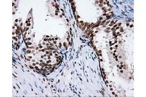 Immunohistochemical staining of paraffin-embedded Kidney tissue using anti-RC204952 mouse monoclonal antibody.