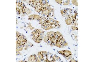 Immunohistochemistry of paraffin-embedded human stomach using CHIC2 antibody (ABIN6130103, ABIN6138533, ABIN6138534 and ABIN6223980) at dilution of 1:100 (40x lens). (CHIC2 抗体  (AA 1-165))