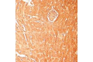 Immunohistochemistry of paraffin-embedded mouse heart using CPT1B antibody (ABIN6130130, ABIN6138978, ABIN6138979 and ABIN6222544) at dilution of 1:100 (40x lens). (CPT1B 抗体  (AA 533-772))