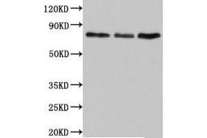 Western Blot Positive WB detected in: Jurkat whole cell lysate, Rat lung tissue, Mouse liver tissue All lanes: SUN2 antibody at 4. (SUN2 抗体  (AA 45-155))