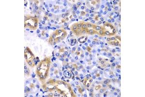 Immunohistochemistry of paraffin-embedded mouse kidney using SYNCRIP antibody.