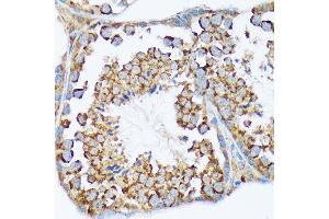 Immunohistochemistry of paraffin-embedded mouse testis using W/W/W Rabbit mAb (ABIN7271346) at dilution of 1:100 (40x lens). (WASF2 抗体)