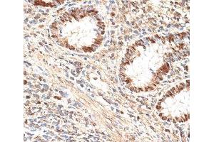 Immunohistochemistry of paraffin-embedded Human appendix using MCM5 Polyclonal Antibody at dilution of 1:100 (40x lens). (MCM5 抗体)