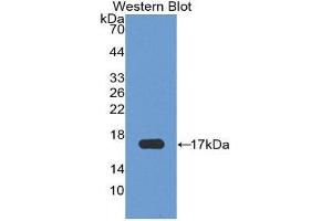 Western Blotting (WB) image for anti-Retinoic Acid Receptor Responder (Tazarotene Induced) 2 (RARRES2) (AA 33-158) antibody (ABIN3201548) (Chemerin 抗体  (AA 33-158))