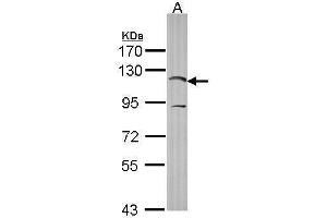 WB Image Sample (30 ug of whole cell lysate) A: HCT116 7. (PIK3CA 抗体  (N-Term))