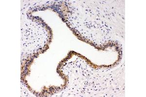 Immunohistochemistry (IHC) image for anti-Neurotrophic tyrosine Kinase, Receptor, Type 3 (NTRK3) (AA 167-182) antibody (ABIN3028867)
