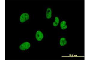 Immunofluorescence (IF) image for anti-Cleavage and Polyadenylation Specific Factor 7, 59kDa (CPSF7) (AA 1-471) antibody (ABIN949659)