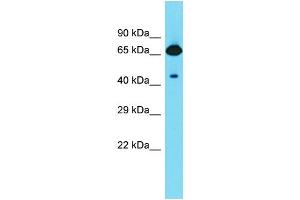 Host: Rabbit  Target Name: Frmd6  Sample Tissue: Rat Stomach lysates  Antibody Dilution: 1. (FRMD6 抗体  (C-Term))