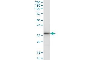 Immunoprecipitation of LRRK1 transfected lysate using anti-LRRK1 MaxPab rabbit polyclonal antibody and Protein A Magnetic Bead , and immunoblotted with LRRK1 purified MaxPab mouse polyclonal antibody (B01P) . (LRRK1 抗体  (AA 1-261))