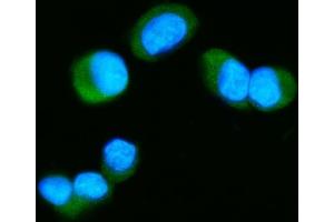 IF analysis of Tau/MAPT using anti-Tau/MAPT antibody (ABIN7599268). (MAPT 抗体  (AA 1-322))