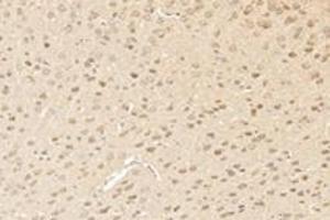 Immunohistochemistry analysis of paraffin-embedded mouse striatum using,RHOBTB3 (ABIN7075422) at dilution of 1: 3600 (RHOBTB3 抗体)