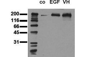 Western Blotting (WB) image for anti-Epidermal Growth Factor Receptor (EGFR) (pTyr1173) antibody (ABIN126779) (EGFR 抗体  (pTyr1173))