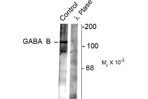 Western blots of rat synaptic membrane showing specific immunolabeling of the ~102 k GABAB R2 protein phosphorylated at Ser783 (control). (GABBR2 抗体  (pSer783))