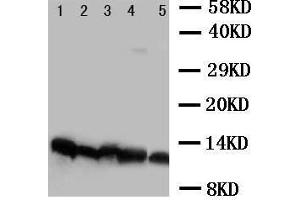 Anti-NDUFA1 antibody, Western blotting Lane 1: Rat Cardiac Muscle Tissue Lysate Lane 2: Rat Liver Tissue Lysate Lane 3: Rat Kidney Tissue Lysate Lane 4: Rat Brain Tissue Lysate Lane 5:  Cell Lysate (NDUFA1 抗体  (C-Term))