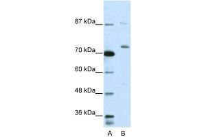 WB Suggested Anti-EXOSC10 Antibody Titration:  5. (EXOSC10 抗体  (C-Term))
