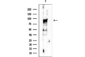 anti-Nucleolar Protein 1 (NOL1) antibody