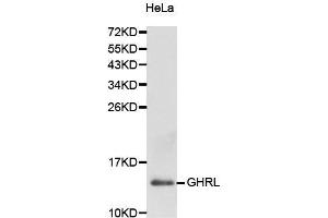 Western Blotting (WB) image for anti-Ghrelin (GHRL) (AA 1-117) antibody (ABIN6217352) (Ghrelin 抗体  (AA 1-117))