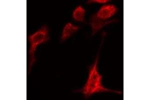 ABIN6279082 staining HeLa cells by IF/ICC. (ADAMTS1 抗体  (Internal Region))