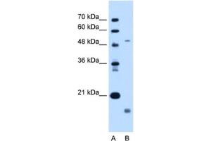 Western Blotting (WB) image for anti-Zinc Metalloproteinase, Ste24 (Zmpste24) antibody (ABIN2462996) (ZMPSTE24 抗体)