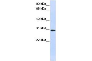 WB Suggested Anti-C6orf21 Antibody Titration:  0. (LY6G6F 抗体  (Middle Region))