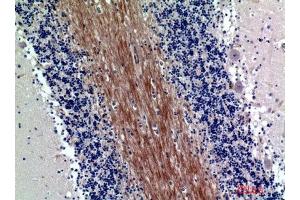Immunohistochemical analysis of paraffin-embedded human-brain, antibody was diluted at 1:200 (SIRPA/SIRPB1 (Internal Region) 抗体)