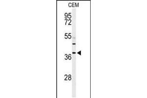 Western blot analysis of RNASEH2B Antibody in CEM cell line lysates (35ug/lane) (RNASEH2B 抗体  (AA 130-157))