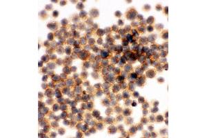 Anti-RIAM antibody, ICC ICC: JURKAT Cell (Amyloid beta (A4) Precursor Protein-Binding, Family B, Member 1 Interacting Protein (APBB1IP) (AA 647-666), (C-Term) 抗体)