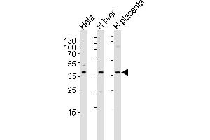 Western blot analysis of lysates from Hela cell line , human liver and placenta tissue lysate(from left to right), using OLR1 Antibody at 1:1000 at each lane. (OLR1 抗体  (AA 64-92))