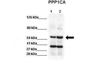 WB Suggested Anti-PPP1CA Antibody  Positive Control: Lane 1:441 µg HEK293 lysate Lane 2: 041 µg H1299 lysate Primary Antibody Dilution: 1:0000Secondary Antibody: Goat anti-rabbit-HRP Secondry  Antibody Dilution: 1:0000Submitted by: Jose Luis Rosa, Universitat de Barcelona (PPP1CA 抗体  (N-Term))