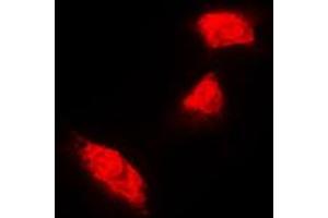 Immunofluorescent analysis of Cytokeratin 18 staining in A431 cells. (Cytokeratin 18 抗体  (C-Term))