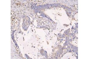 IHC analysis of APOBEC3G using anti-APOBEC3G antibody (ABIN6719444).
