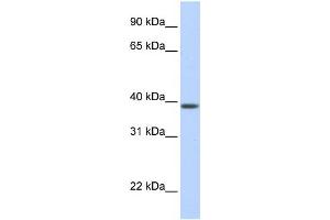 WB Suggested Anti-SLC25A42 Antibody Titration:  0. (SLC25A42 抗体  (N-Term))