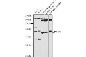 Western blot analysis of extracts of various cell lines, using P antibody (ABIN6132104, ABIN6140406, ABIN6140407 and ABIN6224794) at 1:1000 dilution. (F2RL1 抗体  (AA 318-397))