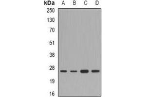 Western blot analysis of FAM173B expression in A549 (A), mouse liver (B), mouse heart (C), rat brain (D) whole cell lysates. (FAM173B 抗体)