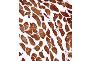 Immunohistochemistry (Paraffin-embedded Sections) (IHC (p)) image for anti-Actin, alpha 1, Skeletal Muscle (ACTA1) (AA 346-375), (C-Term) antibody (ABIN658563)