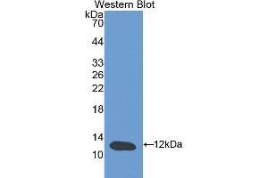 Western Blotting (WB) image for anti-Cystatin B (Stefin B) (CSTB) (AA 2-98) antibody (ABIN1077972) (CSTB 抗体  (AA 2-98))