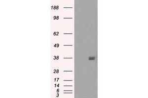 Image no. 6 for anti-Fc gamma RII (CD32) antibody (ABIN1497256) (Fc gamma RII (CD32) 抗体)
