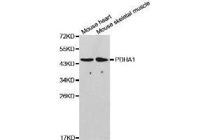 Western blot analysis of extracts of various cell lines, using PDHA1 antibody.